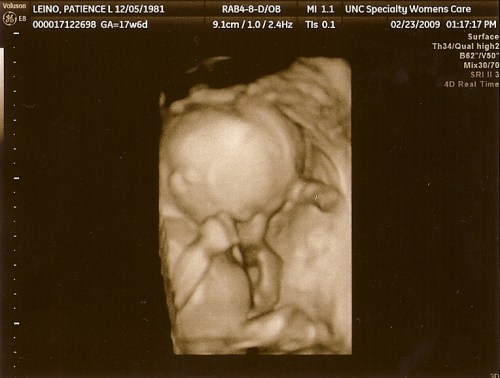 leino-baby-2-fourth40fbd1