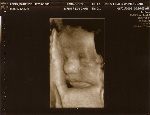 Leino Baby #2 Sonogram 06-01-09 1