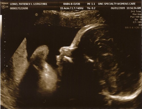 Leino Baby #2 Sonogram 06-01-09 3